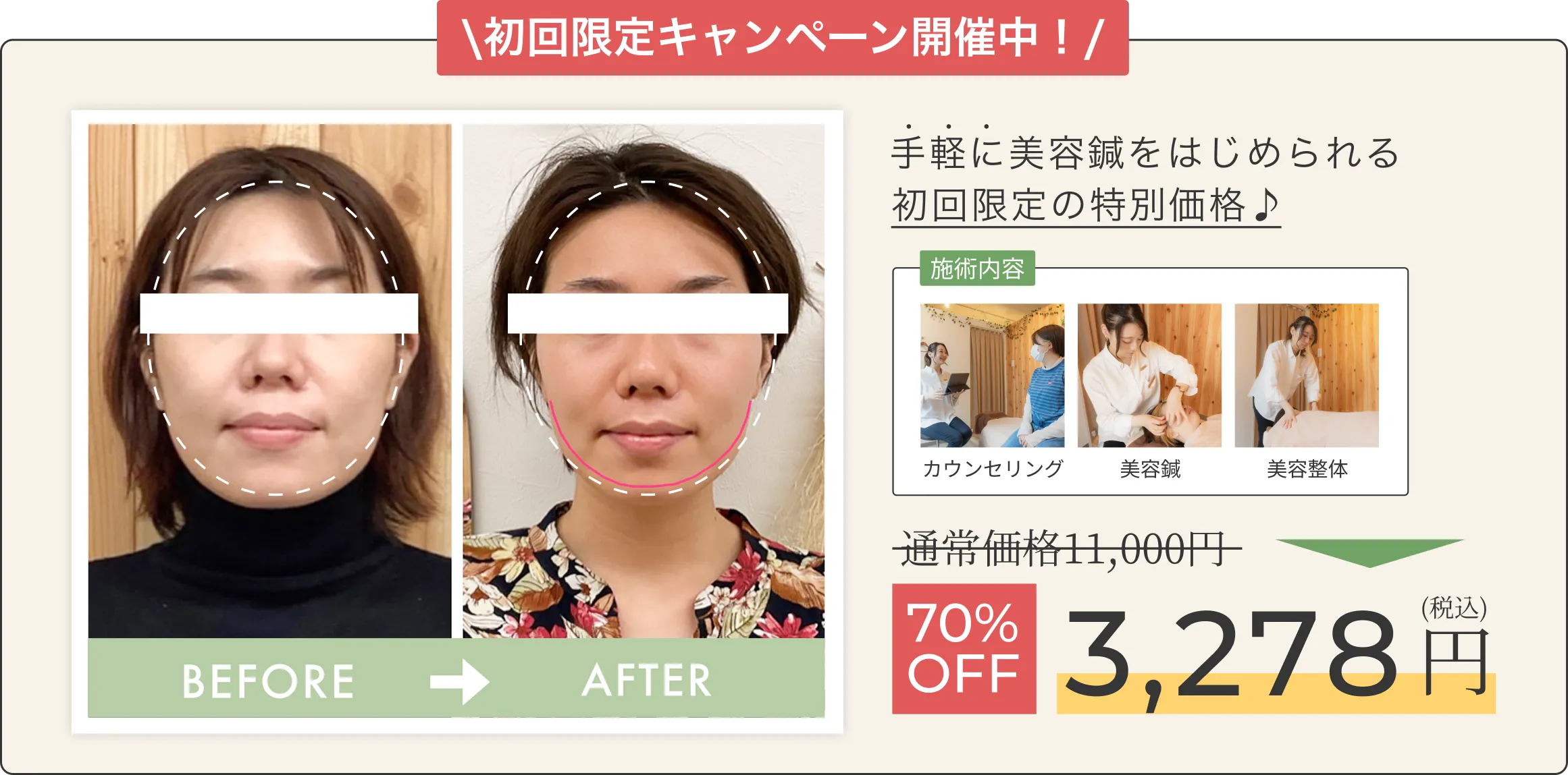 初回限定キャンペーン開催中!