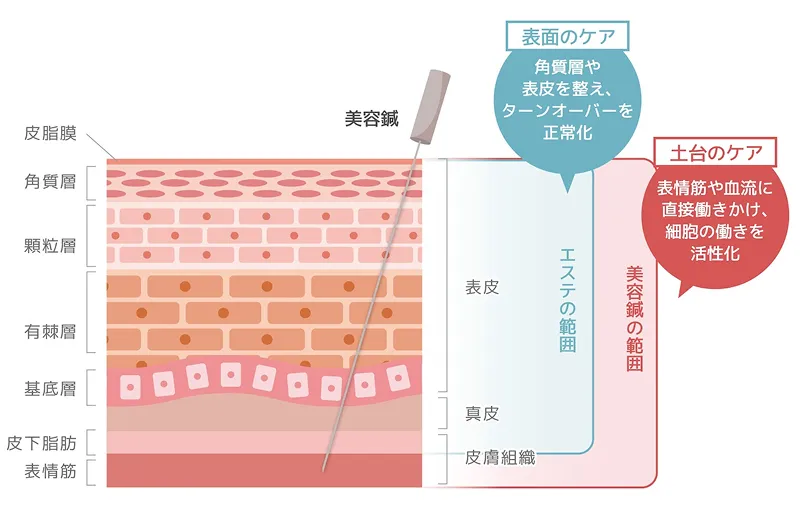 美容鍼とエステの違い