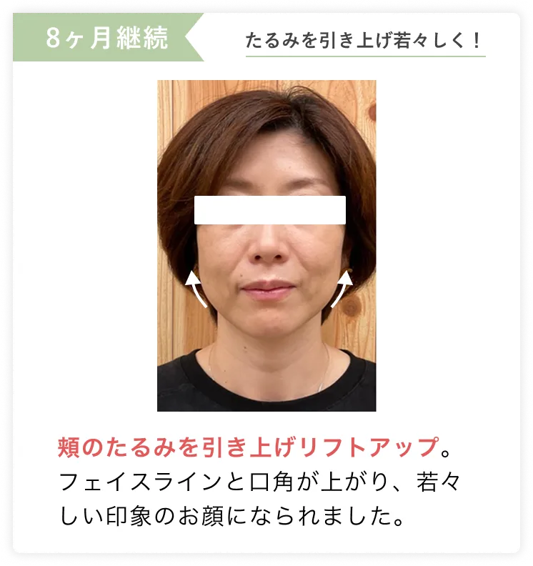 たるみを引き上げ若々しく！