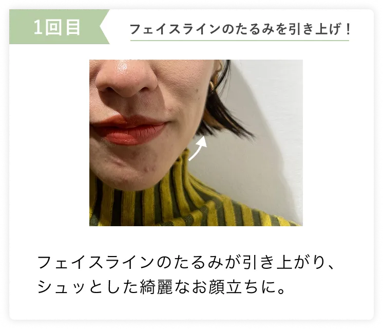 たるみ、むくみ解消で小顔に