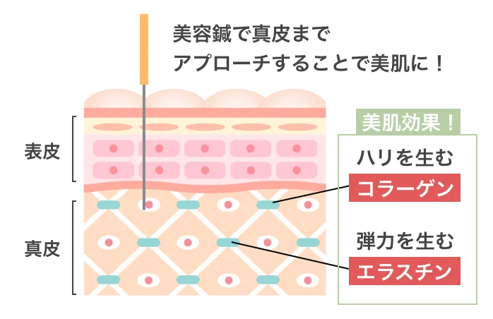 継続施術による美肌の効果