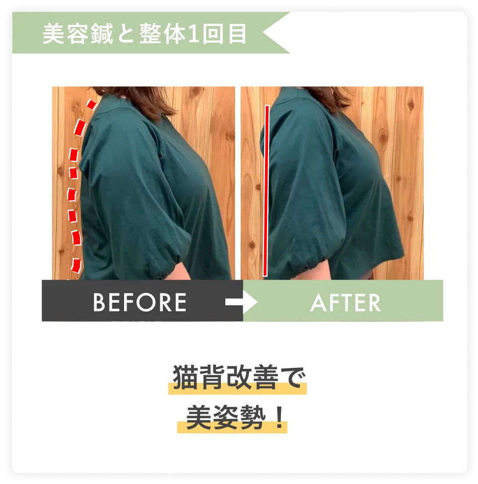 猫背改善で美姿勢へ