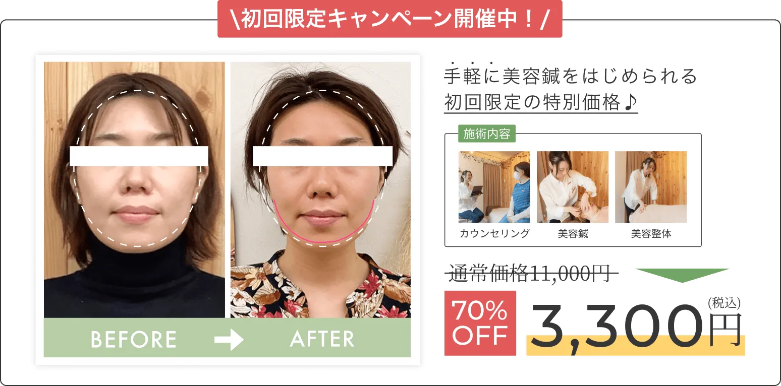 初回限定キャンペーン開催中！