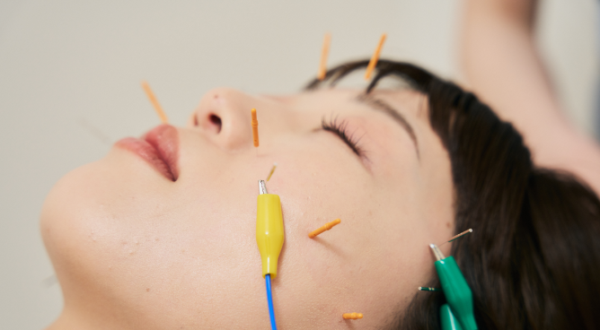 ハリナチュレの美容鍼