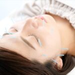 美容鍼を受ける女性