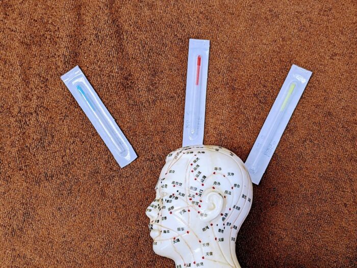 美容鍼の内出血は決して悪いものではない