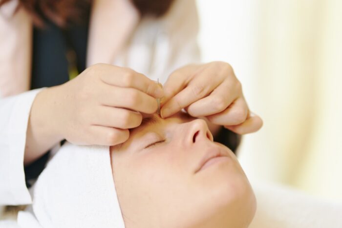 美容鍼後に肌荒れのように見える主な3つの原因