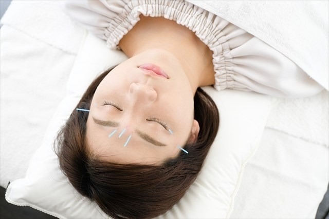 美容鍼が頭痛に有効な理由