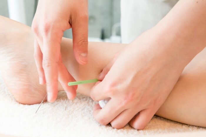 美容鍼と整体を合わせて受けるなら定額制サロン「ハリナチュレ」にご相談ください