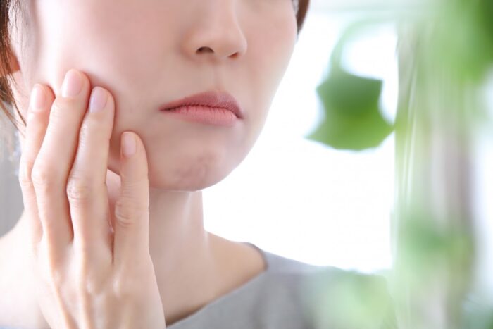 ほうれい線の改善