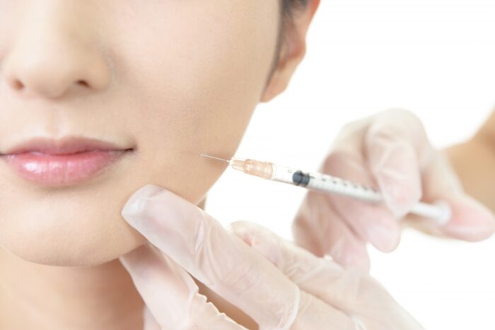 ボトックス注射で期待できる効果