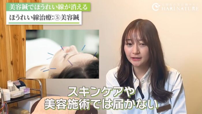 治療法比較一覧表