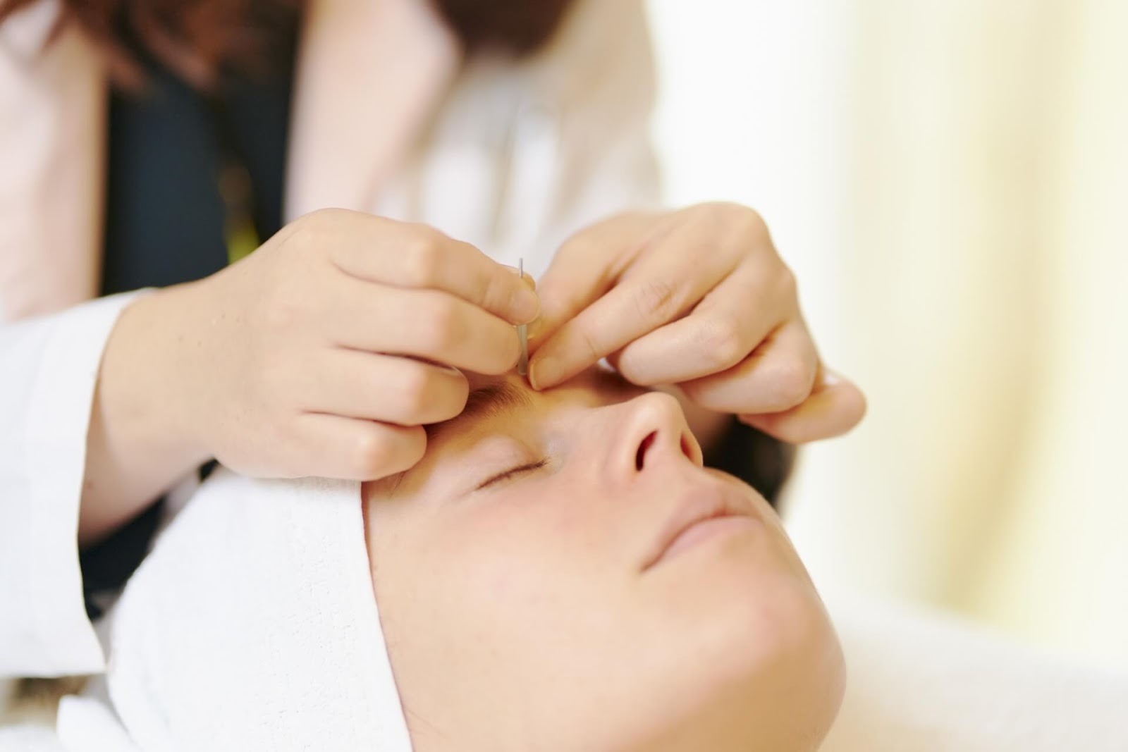 美容鍼 刺さない