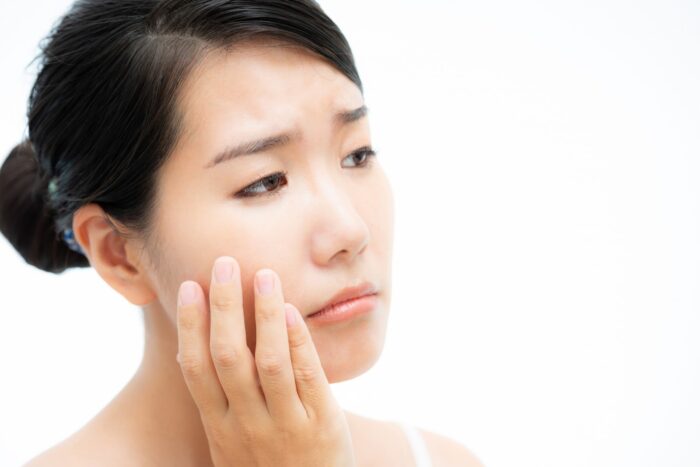 美容鍼 好転反応