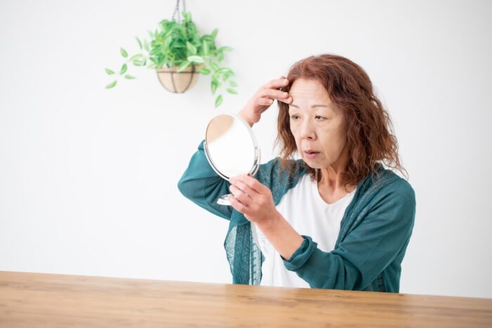 美容鍼 眉間のしわ