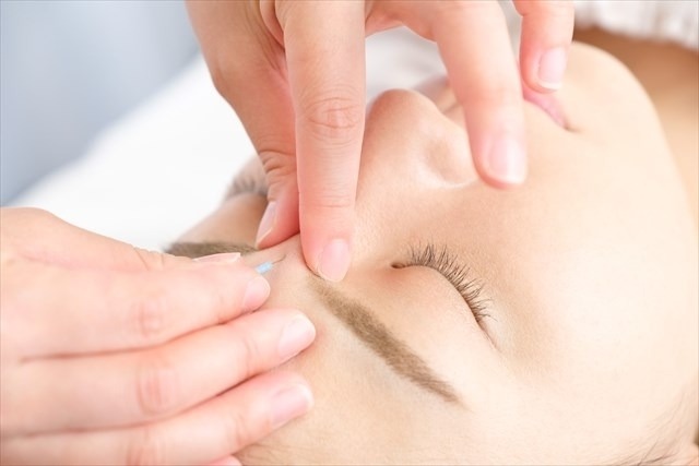 美容鍼 眉間のしわ