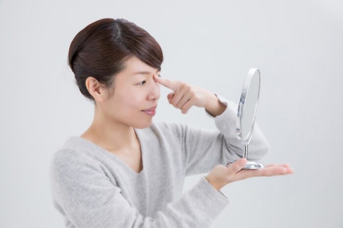 美容鍼 眉間のしわ