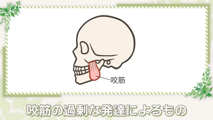 エラが張る主な要因は筋肉の過剰発達