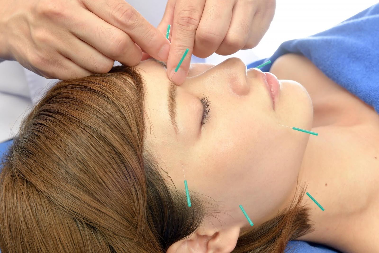 美容鍼 危険