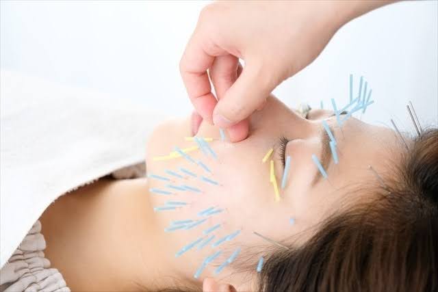 美容鍼 ツボ
