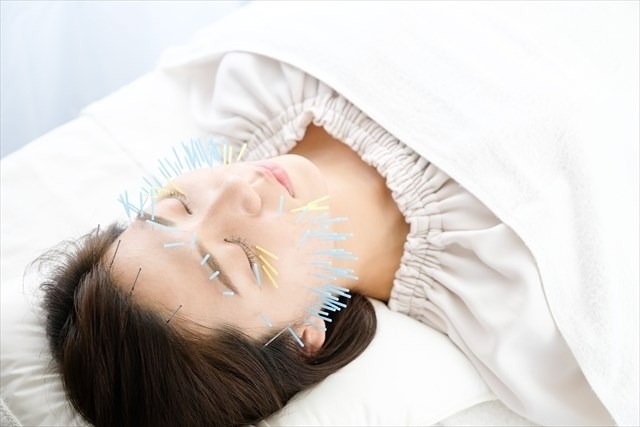 美容鍼施術で期待できる5つの効果
