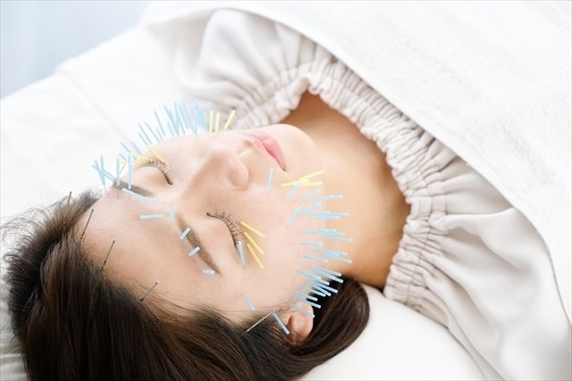 美容鍼と小顔矯正はどっちがいい？