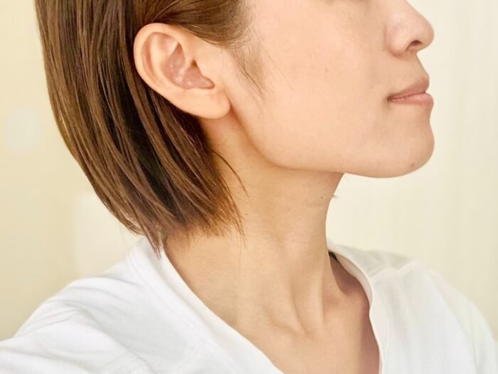 エラ張りが与える見た目の印象とは？