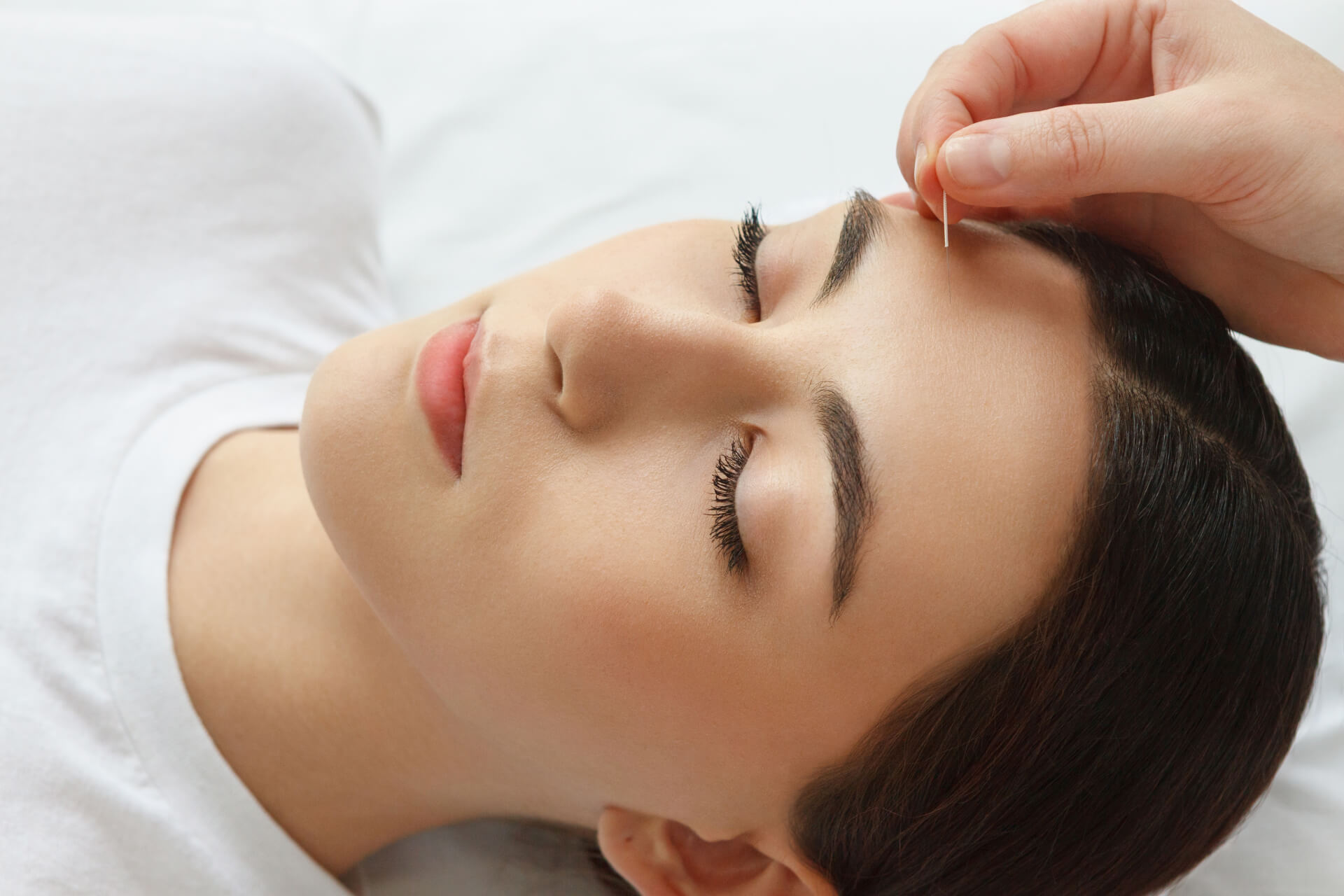 美容鍼は月一回でも効果ある？持続期間や理想の頻度・効果を高めるポイントまで解説